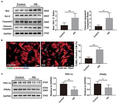 Traditional Chinese Medication Qiliqiangxin Attenuates Diabetic Cardiomyopathy via Activating PPARγ